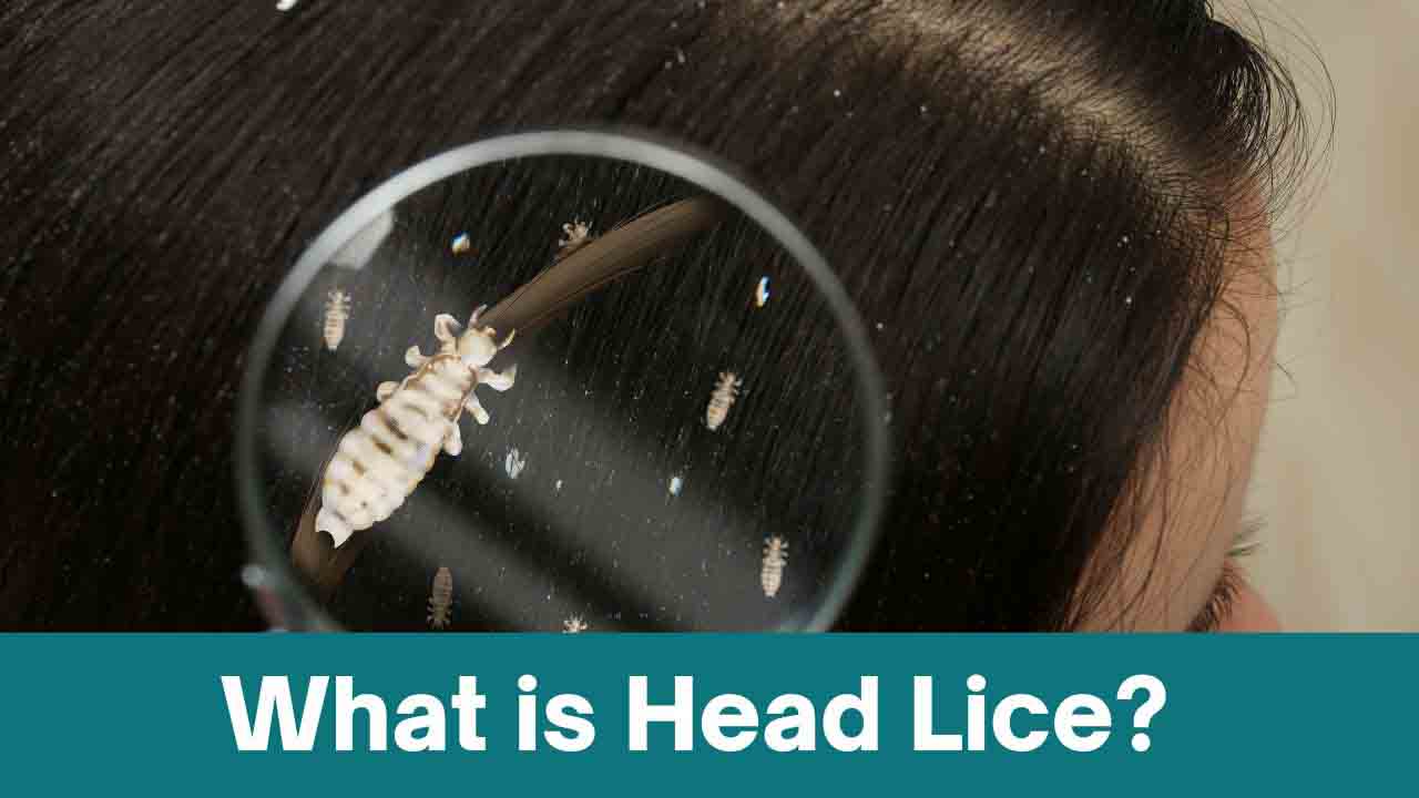 What is Head Lice?