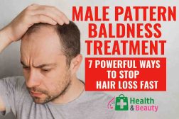 Male Pattern Baldness Treatment: 7 Powerful Ways to Stop Hair Loss Fast