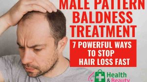 Male Pattern Baldness Treatment: 7 Powerful Ways to Stop Hair Loss Fast