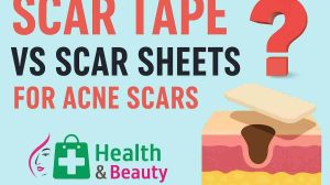 Scar Tape vs Scar Sheets for Acne Scars